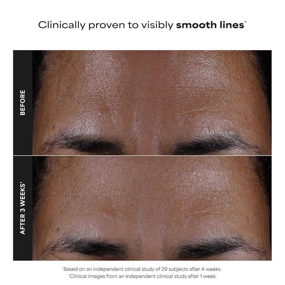 Paula's Choice SKIN PERFECTING 2% BHA Liquid Exfoliant with Salicylic Acid, Facial Polish for Pores, Wrinkles & Fine Lines, Suitable for Blackhead-Prone Skin, Fragrance-Free
